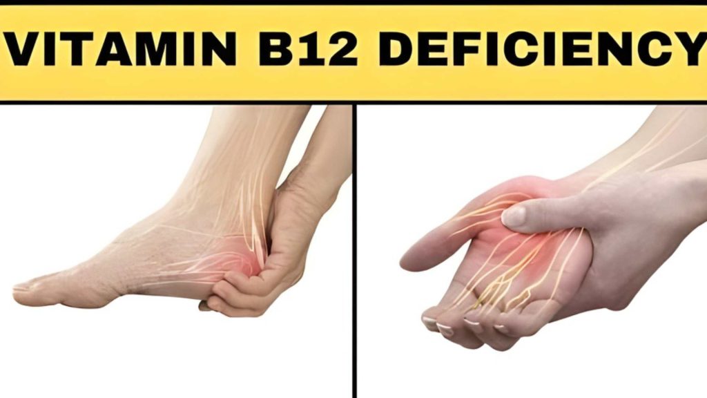 Symptoms of Vitamin B12 Deficiency