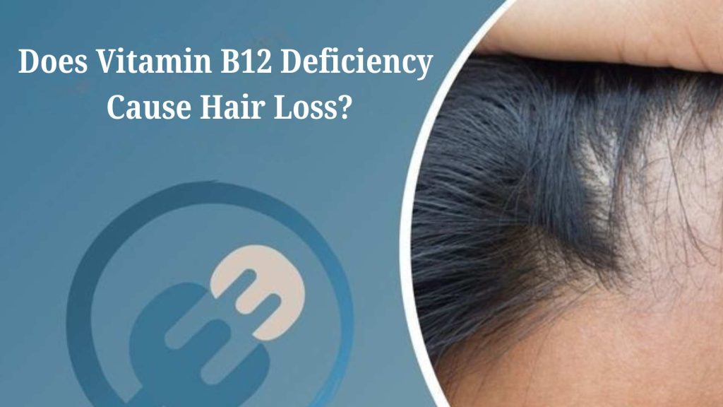 Vitamin B12 Deficiency Cause Hair Loss